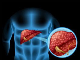 脂肪肝不只傷肝！研究脂肪肝還會提升心臟病和肺癌風險