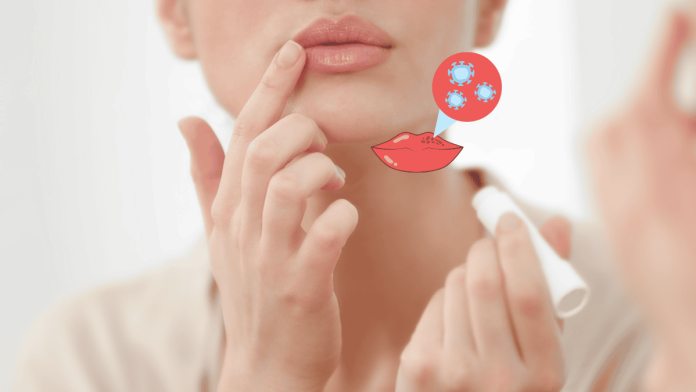 5 Causes Of Chapped Lips, And How Treatment Improves