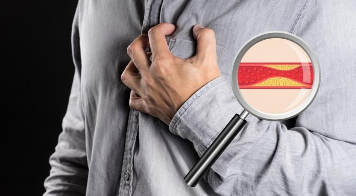 Arteriosclerotic Examination