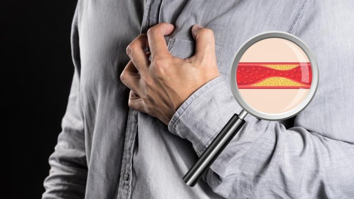 Arteriosclerotic Examination