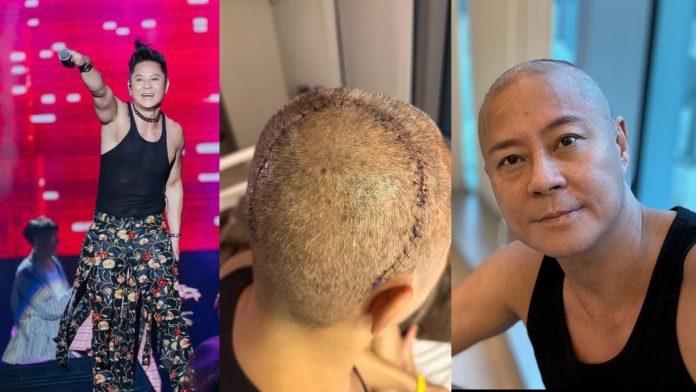 Brain Tumor Remus Choy