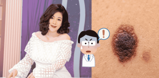 Chen Wenqian Melanoma Cancer