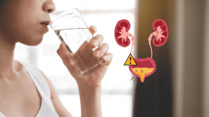 Drinking Water In The Wrong Way Increase The Risk Of Urinary Tract Stones