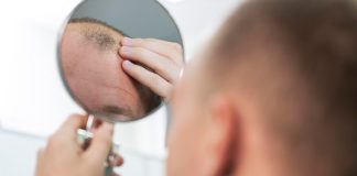 Follicular Unit Transplantation