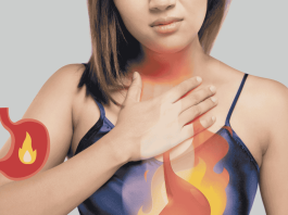中醫師你三招遠離「火燒心」,拒絕胃食道逆流反覆發作 Gastroesophageal Reflux Disease Tcm
