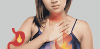 Gastroesophageal Reflux Disease Tcm