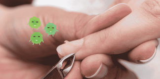Hangnail