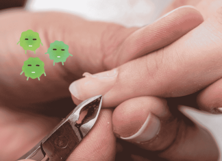 Hangnail