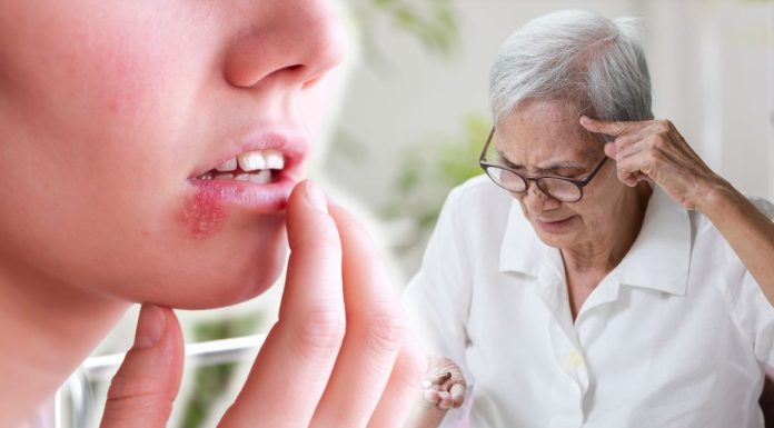 Human Herpes Virus Accelerates The Development Of Alzheimer's Disease
