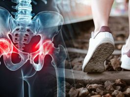 Judge The Health Of The Hip Joint From The Sole Of The Shoe