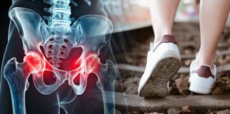 Judge The Health Of The Hip Joint From The Sole Of The Shoe