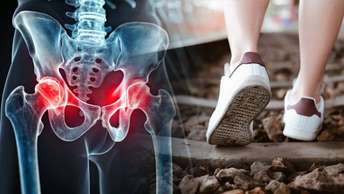 Judge The Health Of The Hip Joint From The Sole Of The Shoe