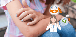 Mosquito Bites 5 Kinds Of Anti Itch Ointment