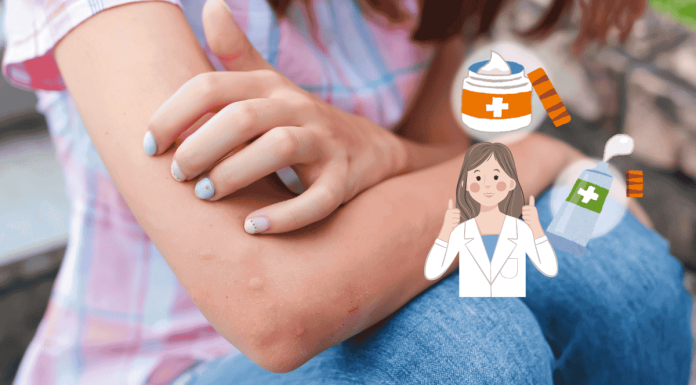 Mosquito Bites 5 Kinds Of Anti Itch Ointment