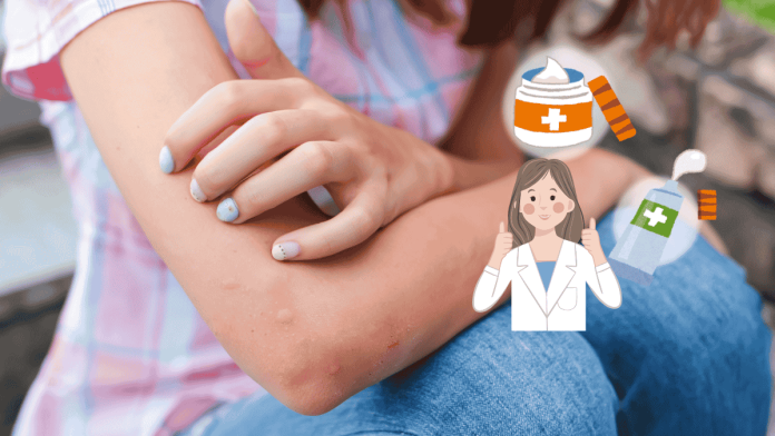 Mosquito Bites 5 Kinds Of Anti Itch Ointment