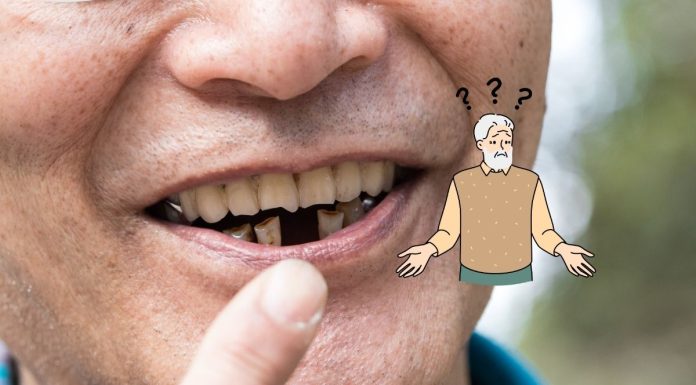 Periodontal Disease And Missing Teeth Increase The Risk Of Dementia