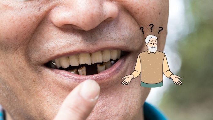 Periodontal Disease And Missing Teeth Increase The Risk Of Dementia