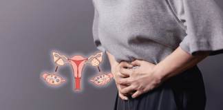 Polycystic Ovaries Syndrome Integration Of Traditional And Western Medicine