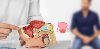 Prostate Hypertrophy