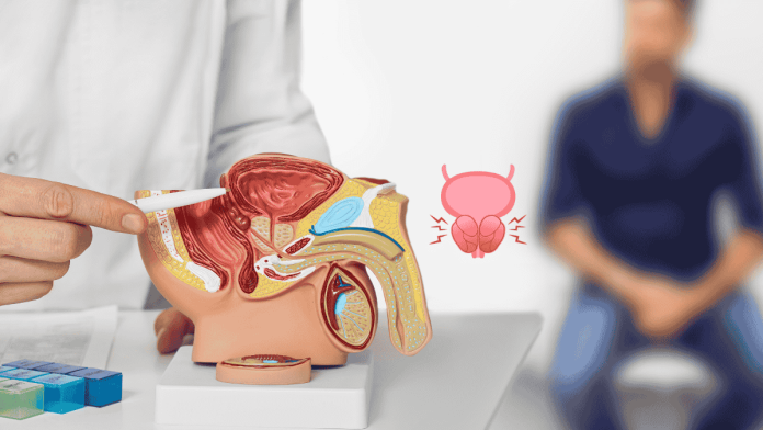 Prostate Hypertrophy