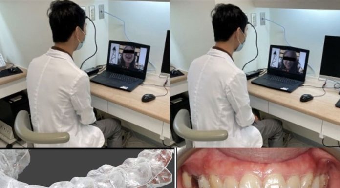隱形牙套加遠距醫療？ 陪你 在家齒顎矯正