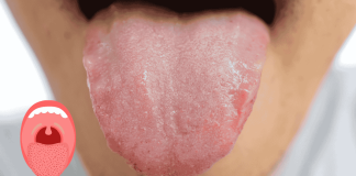 Tongue