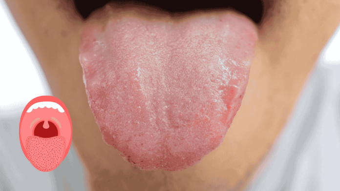 Tongue