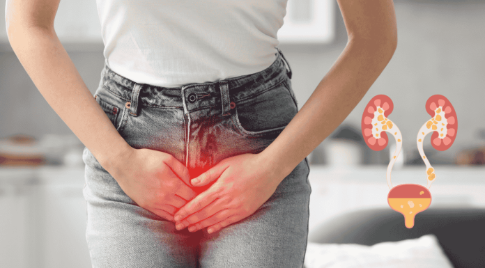 Urinary calculi