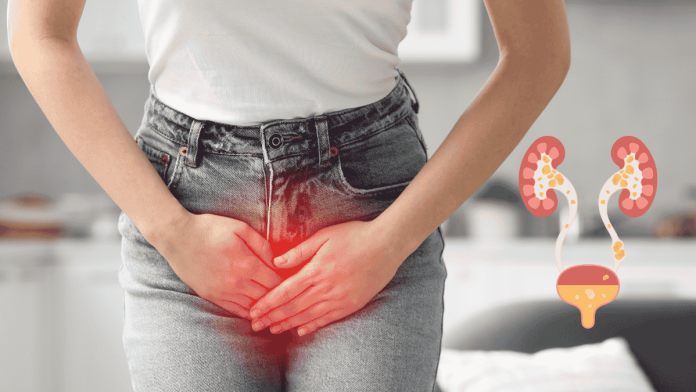 Urinary calculi