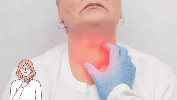 A Retrosternal Goiter