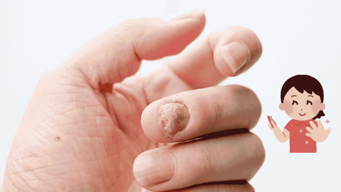 Abnormal Nail