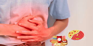 Acute Pancreatitis