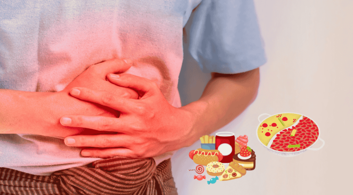 Acute Pancreatitis