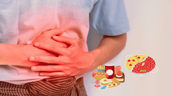 Acute Pancreatitis