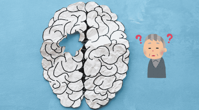 Aging Dementia
