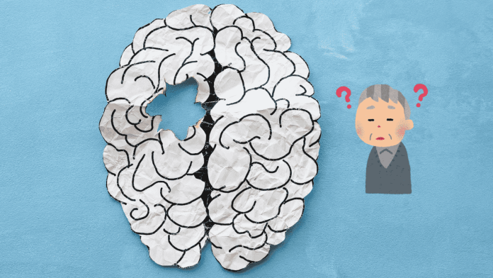 Aging Dementia