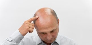 Baldness