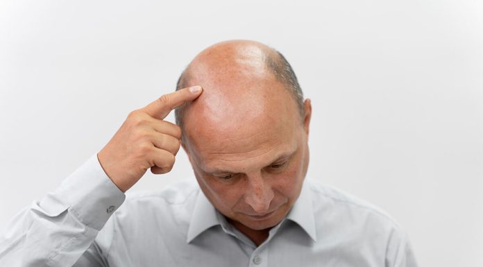 Baldness