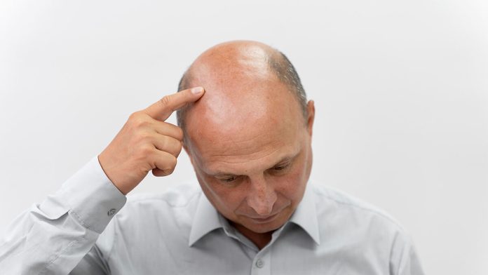 Baldness