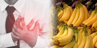Banana Hyperkalemia Kidney Diet