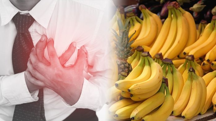 Banana Hyperkalemia Kidney Diet