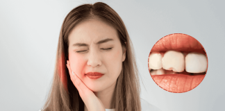 Biting Ice Cracked Teeth