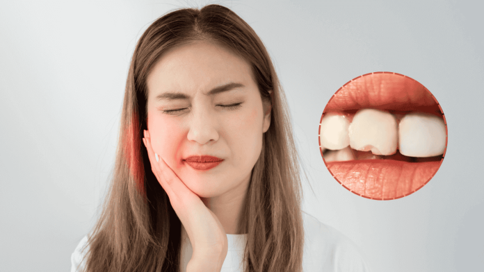 Biting Ice Cracked Teeth