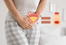 Bladder Shrinkage Frequent Urination Warning