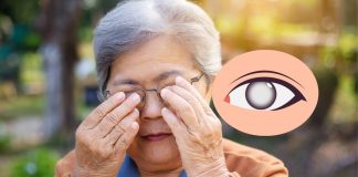 Cataract