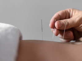 Close Up Hand Holding Acupuncture Needle (1)