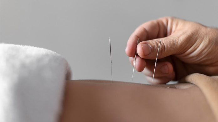 Close Up Hand Holding Acupuncture Needle (1)