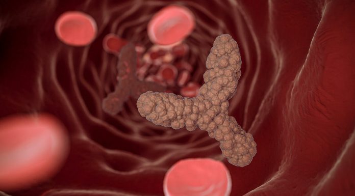 Colon Cancer