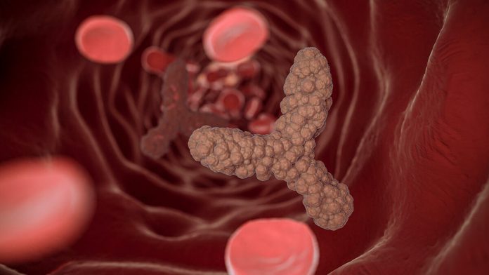 Colon Cancer