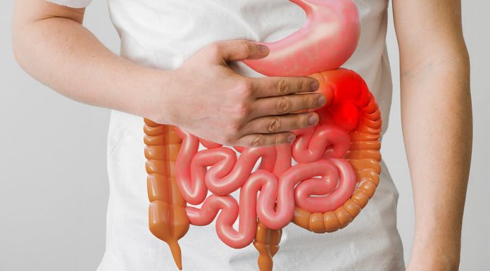 Colon Cancer In Young Adults 1
